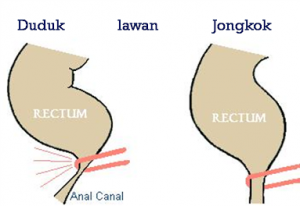 posisi closet duduk dan jongkok